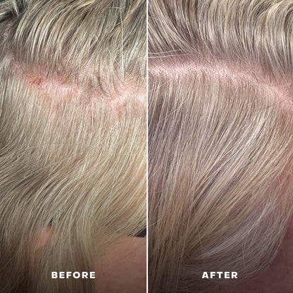 EverBoost Multi-Peptide Scalp Serum